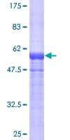 Human HGD Protein (Recombinant GST)
