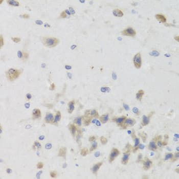 Polyclonal Rabbit anti-Human ISG15 Antibody (IHC, WB)
