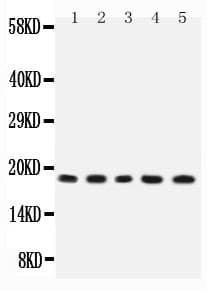 Polyclonal Rabbit anti-Rat IL2 Antibody (aa21-155, WB)