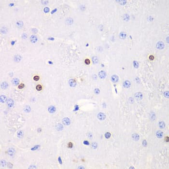 TKT / Transketolase Antibody