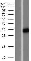 PGAM5 Protein (Over-Expression Lysate Myc-DDK (Flag))