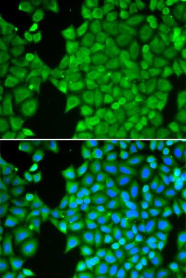 Polyclonal Rabbit anti-Human CA3 / Carbonic Anhydrase III Antibody (IF, WB)