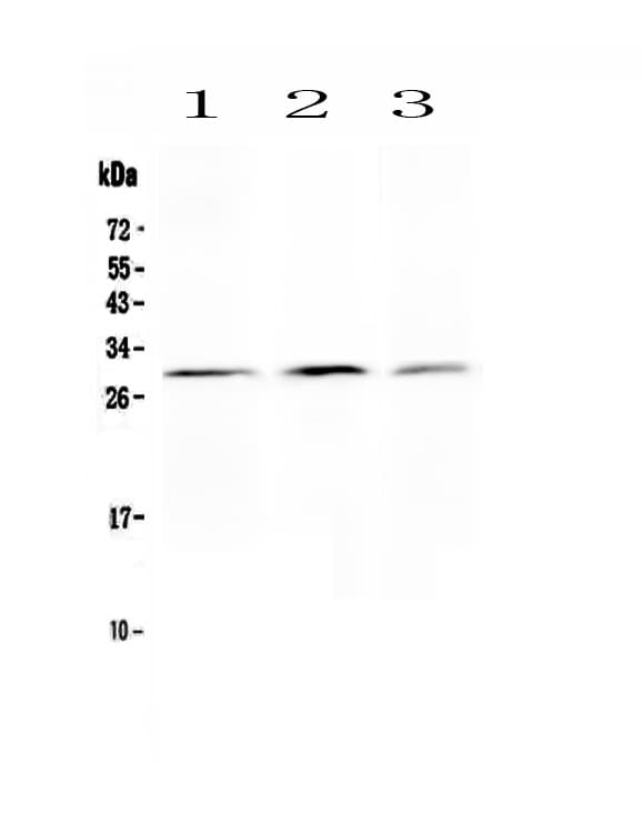 Polyclonal Rabbit anti-Human KLK2 / Kallikrein 2 Antibody (aa243-261, IHC, WB)