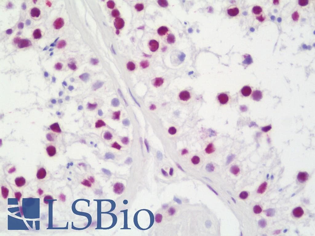 IHC-plus™ Polyclonal Rabbit anti-Human TAF15 Antibody (aa200-250, IHC)