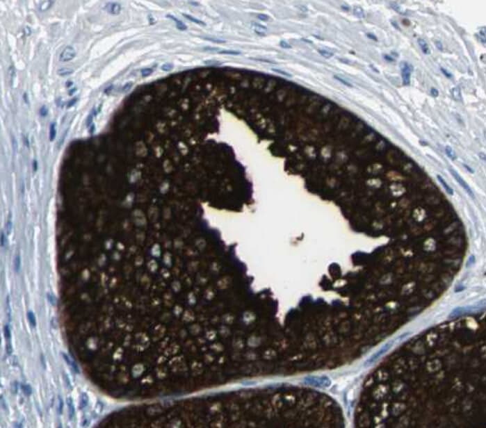Polyclonal Rabbit anti-Human MTOR Antibody (IHC, IF, WB)