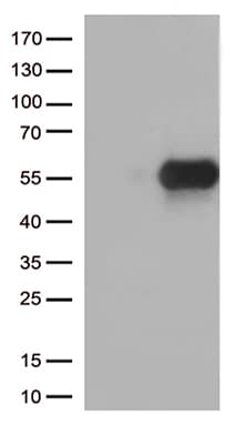 Monoclonal Mouse anti-Human HAVCR2 / TIM-3 Antibody (clone OTI1C4, WB)