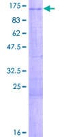 Human ZNF281 / Zfp281 Protein (Recombinant GST)