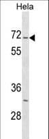 STK3 Antibody (aa387-415)