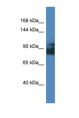 Polyclonal Rabbit anti-Human LRRC8A / LRRC8 Antibody (C-Terminus, WB)