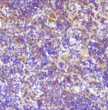 RP2 Antibody