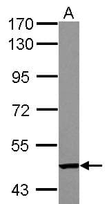 Polyclonal Rabbit anti-Human TC2N Antibody (WB)
