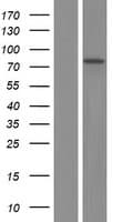 RARS Protein (Over-Expression Lysate Myc-DDK (Flag))