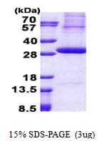 Human KLK2 / Kallikrein 2 Protein (Recombinant His)
