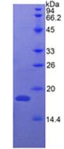 Bovine Ribonuclease A / RNASE1 Protein (Recombinant His, N-Terminal)