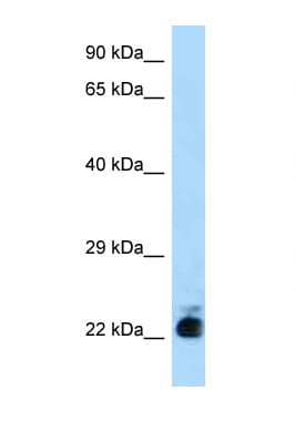 SLC31A1 / CTR1 Antibody (N-Terminus)