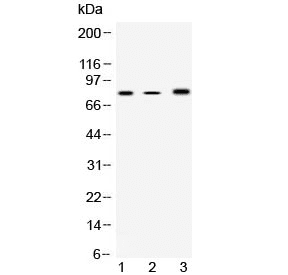 ALOX12 / 12 Lipoxygenase Antibody