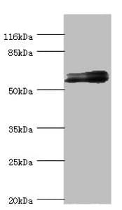 GABRR1 / GABA(A) Receptor rho- Antibody