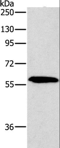 Polyclonal Rabbit anti-Human PAK2 Antibody (IHC, WB)