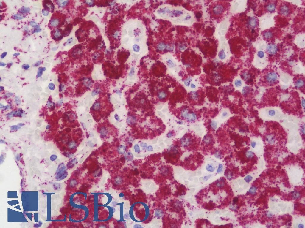 IHC-plus™ Polyclonal Rabbit anti-Human ATP5B / ATP Synthase Beta Antibody (aa135-163, IHC, WB)