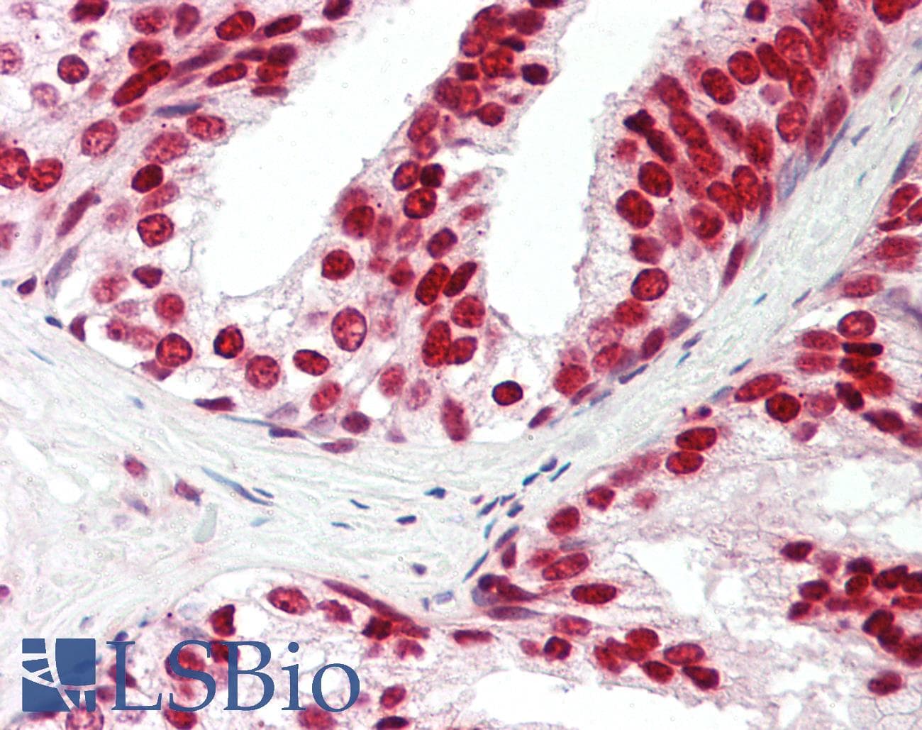 Polyclonal Rabbit anti-Human CIRP / CIRBP Antibody (C-Terminus, IHC, WB)