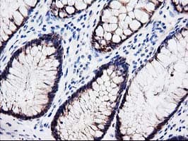 Latexin / MUM Antibody (clone OTI2G4, Carrier-free)