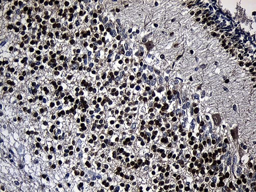 PHF20L1 Antibody (clone OTI1H6)