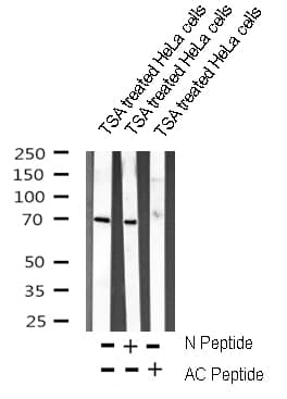 FOXO1 / FKHR Antibody (Acetyl-Lys294)