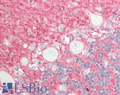 PathPlus™ NCAM / CD56 Antibody (clone 123C3.D5)