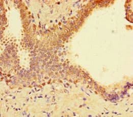 SPT3 / SUPT3H Antibody