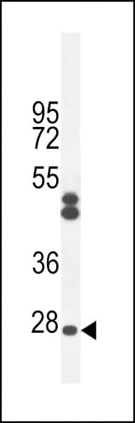Polyclonal Rabbit anti-Human C6orf62 Antibody (aa118-147, IHC, WB)