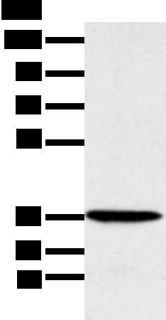 MAT2B Antibody
