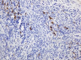 RPN2 / Ribophorin II Antibody (clone OTI1G9)