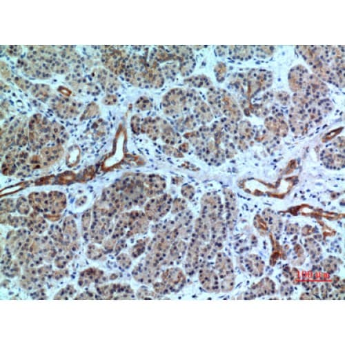 Polyclonal Rabbit anti-Human CXCR6 Antibody (1-50 aa, N-terminal, IHC, WB)