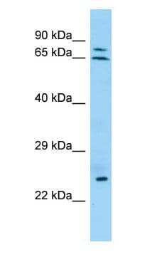 KRT74 / Keratin 74 Antibody (aa106-155)