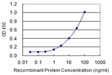 Monoclonal Mouse anti-Human MYO9A Antibody (clone 4C11, WB)