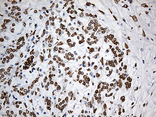 SLU7 / 9G8 Antibody (aa1-300, clone OTI5A7, Carrier-free)