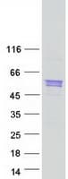 Human SRL / Sarcalumenin Protein (Recombinant Myc-DDK (Flag))