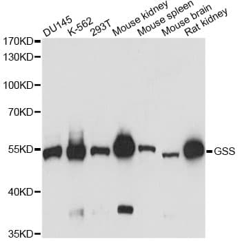 GSS / Glutathione Synthetase Antibody
