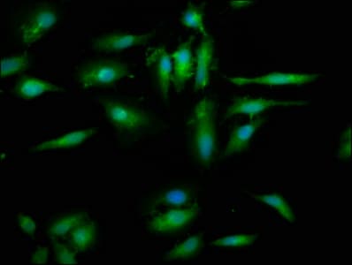 Polyclonal Rabbit anti-Human EYA4 Antibody (IHC, IF)