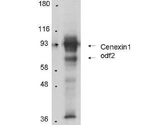 ODF2 Antibody