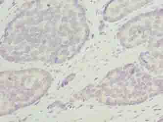 ODF3L1 Antibody