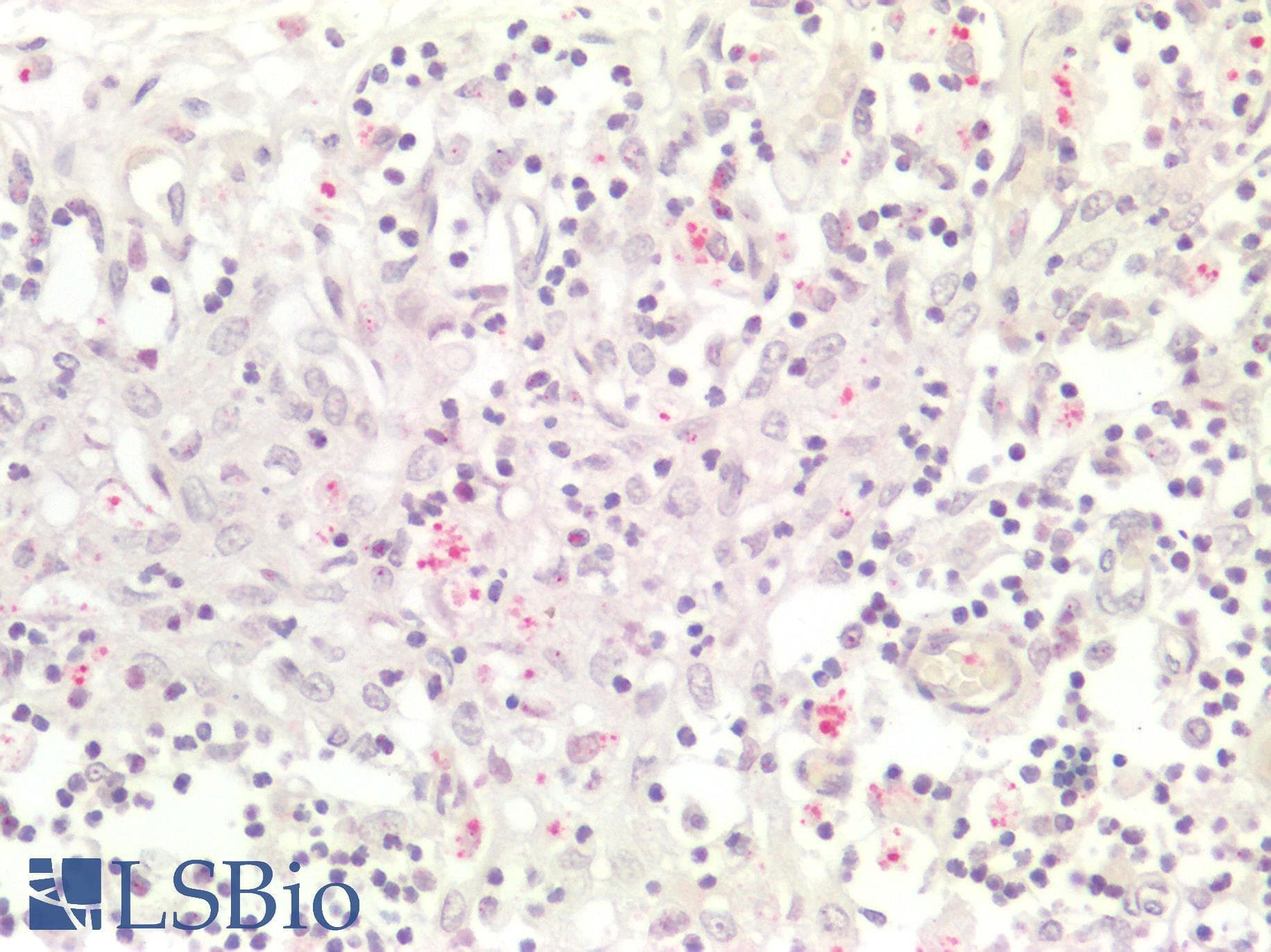 PathPlus™ RB1 / Retinoblastoma / RB Antibody (aa552-601)
