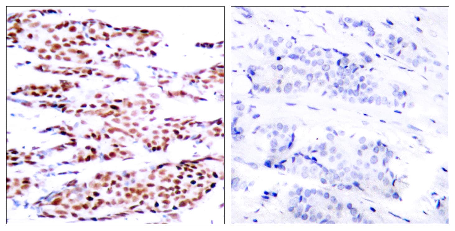 JUNB / JUN-B Antibody (phospho-Ser79)