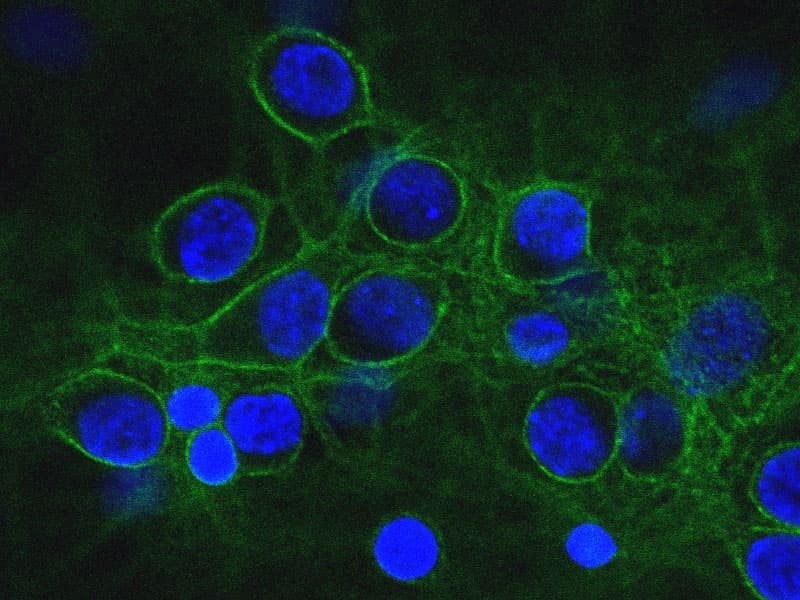 SPTAN1 / Alpha Fodrin Antibody (clone 3D7)