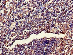 RPL19 / Ribosomal Protein L19 Antibody