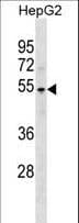 PKNOX1 / PREP1 Antibody (aa387-415)