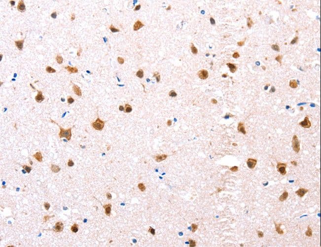 ER Alpha / Estrogen Receptor Antibody