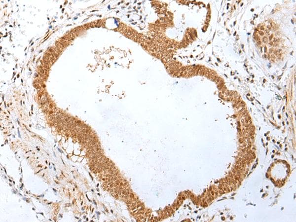 Polyclonal Rabbit anti-Human PEG3 Antibody (IHC)