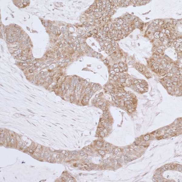 LRPPRC Antibody (aa1344-1394)