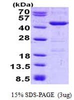 Human YOD1 Protein (Recombinant His)